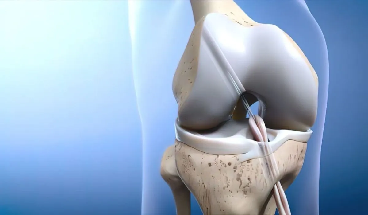 Is A Cartilage Transplant Better Than A Knee Replacement What Is The Knee Cartilage Transplant Success Rate