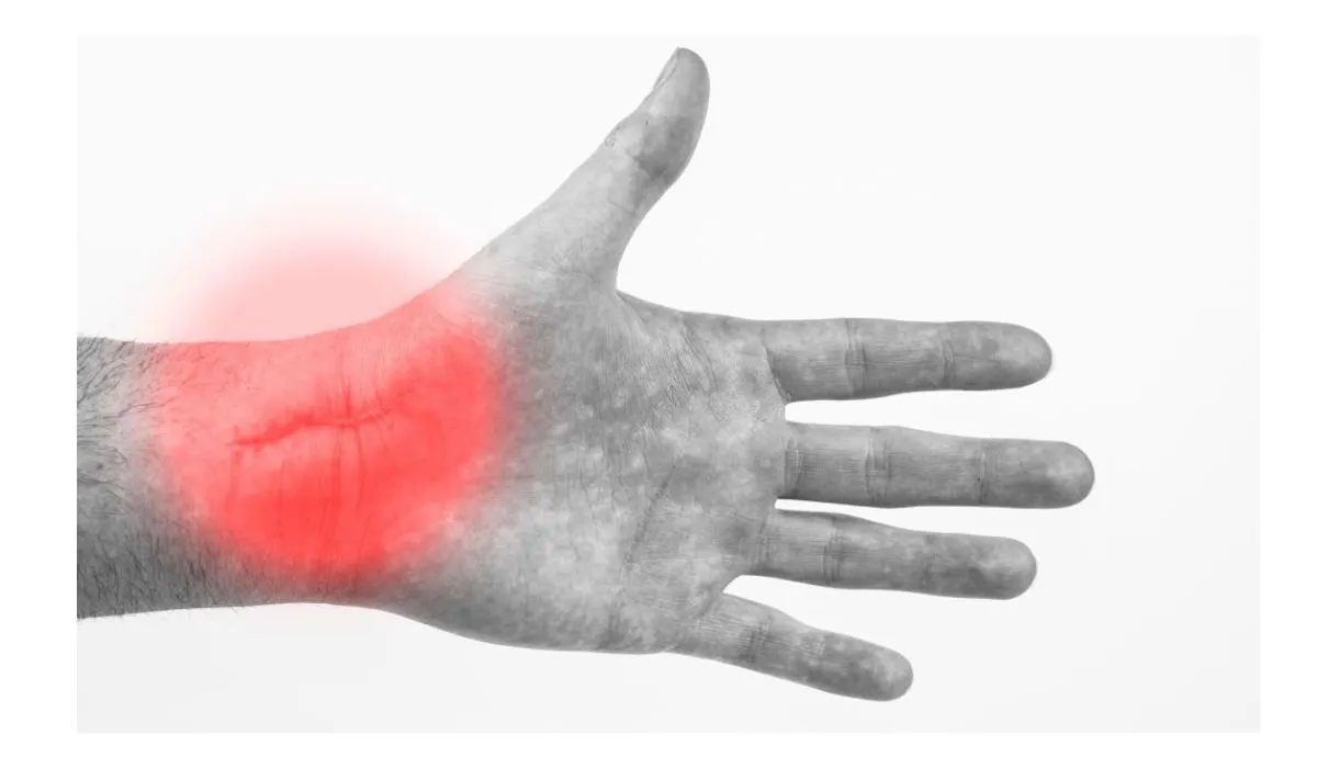 Scaphoid Fracture Surgery What You Need To Know