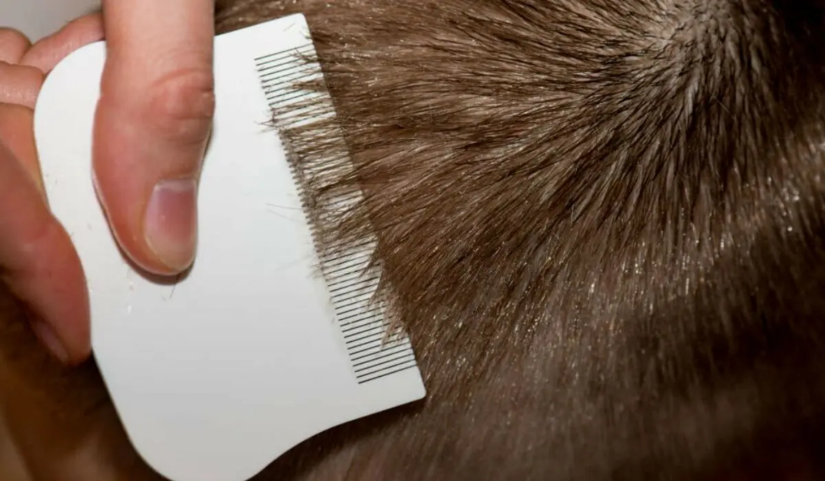 How To Remove Lice From Hair Permanently