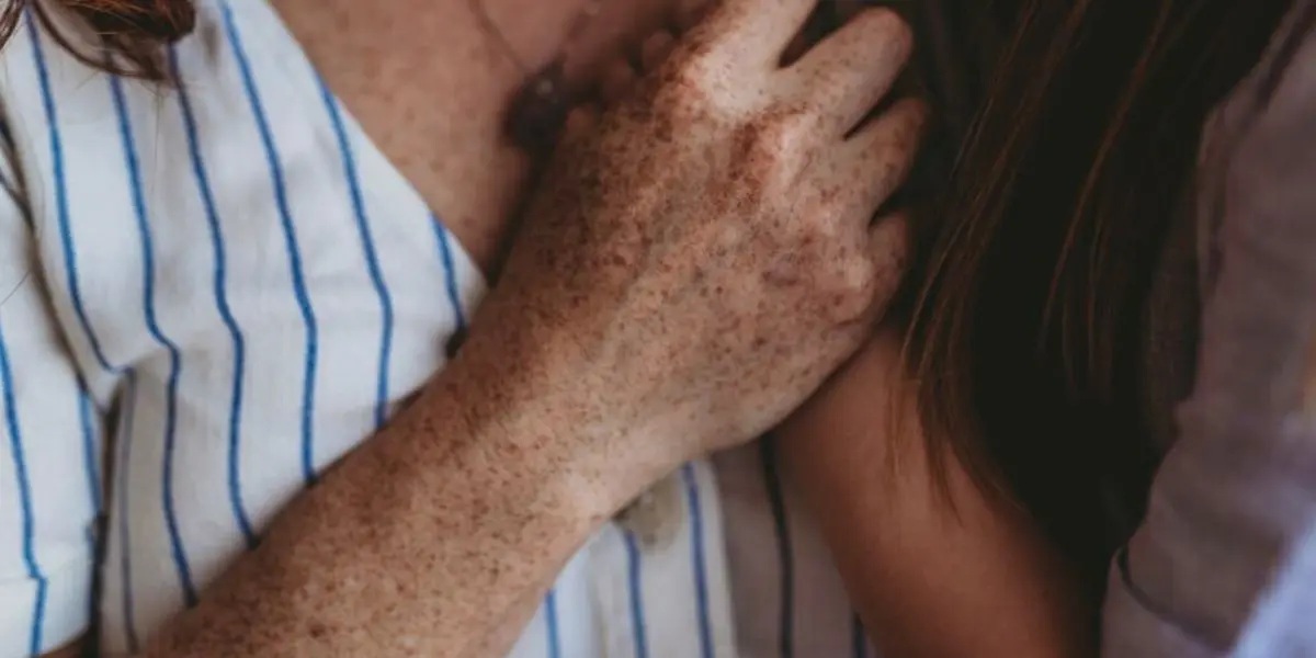 How To Get Rid Of Freckles On Your Arms